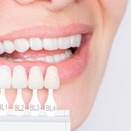 xr:d:DAFCR5GDds8:1467,j:6180468850487252429,t:23092720